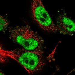 Invitrogen CD2BP2 Polyclonal Antibody 100 &mu;L; Unconjugated:Antibodies,