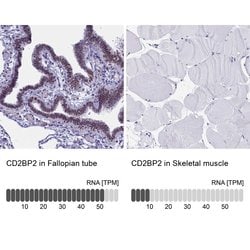 Invitrogen CD2BP2 Polyclonal Antibody 100 &mu;L; Unconjugated:Antibodies,