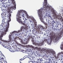 Invitrogen CD2BP2 Polyclonal Antibody 100 &mu;L; Unconjugated:Antibodies,