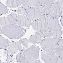 Invitrogen CD2BP2 Polyclonal Antibody 100 &mu;L; Unconjugated:Antibodies,
