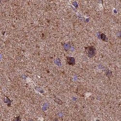 Invitrogen NDUFA8 Polyclonal Antibody 100 &mu;L; Unconjugated:Antibodies,
