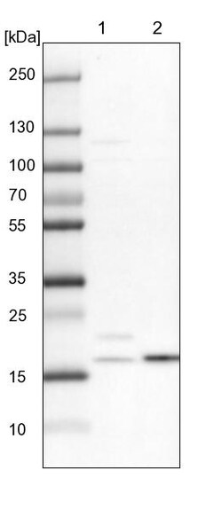 Invitrogen NDUFA8 Polyclonal Antibody 100 &mu;L; Unconjugated:Antibodies,