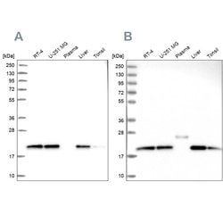 Invitrogen NDUFA8 Polyclonal Antibody 100 &mu;L; Unconjugated:Antibodies,