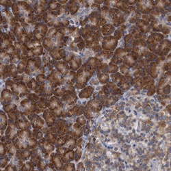 Invitrogen ALG2 Polyclonal Antibody 100 &mu;L; Unconjugated:Antibodies,