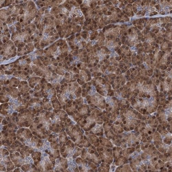 Invitrogen TRAC-1 Polyclonal Antibody 100 &mu;L | Buy Online | Invitrogen&trade; | Fisher Scientific