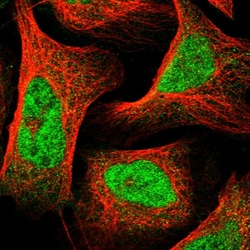 Invitrogen S7A6O Polyclonal Antibody 100 &mu;L; Unconjugated:Antibodies,