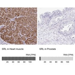 Invitrogen Sarcalumenin Polyclonal Antibody 100 &mu;L; Unconjugated:Antibodies,