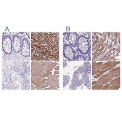 Invitrogen Sarcalumenin Polyclonal Antibody 100 &mu;L; Unconjugated:Antibodies,