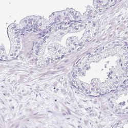 Invitrogen Sarcalumenin Polyclonal Antibody 100 &mu;L; Unconjugated:Antibodies,