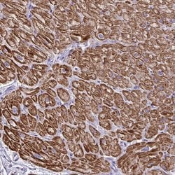 Invitrogen Sarcalumenin Polyclonal Antibody 100 &mu;L; Unconjugated:Antibodies,