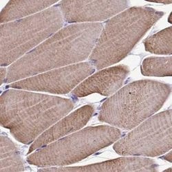 Invitrogen Sarcalumenin Polyclonal Antibody 100 &mu;L; Unconjugated:Antibodies,