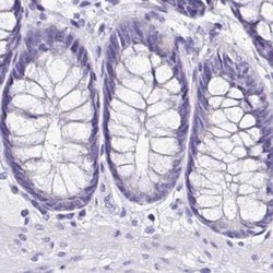 Invitrogen Sarcalumenin Polyclonal Antibody 100 &mu;L; Unconjugated:Antibodies,