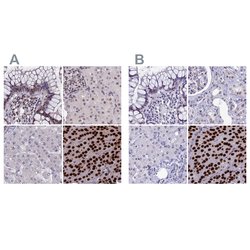 Invitrogen CCDC86 Polyclonal Antibody 100 &mu;L; Unconjugated:Antibodies,