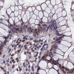 Invitrogen CCDC86 Polyclonal Antibody 100 &mu;L; Unconjugated:Antibodies,