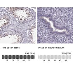 Invitrogen PRSS54 Polyclonal Antibody 100 &mu;L; Unconjugated:Antibodies,