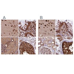 Invitrogen KARS Polyclonal Antibody 100 &mu;L; Unconjugated:Antibodies,