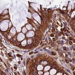 Invitrogen KARS Polyclonal Antibody 100 &mu;L; Unconjugated:Antibodies,