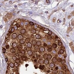 Invitrogen KARS Polyclonal Antibody 100 &mu;L; Unconjugated:Antibodies,
