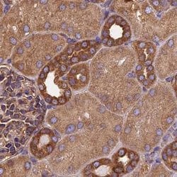 Invitrogen KARS Polyclonal Antibody 100 &mu;L; Unconjugated:Antibodies,