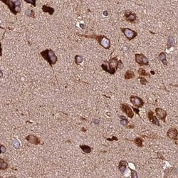Invitrogen KARS Polyclonal Antibody 100 &mu;L; Unconjugated:Antibodies,