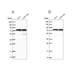 Invitrogen KARS Polyclonal Antibody 100 &mu;L; Unconjugated:Antibodies,
