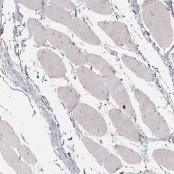 Invitrogen ABCA7 Polyclonal Antibody 100 &mu;L; Unconjugated:Antibodies,