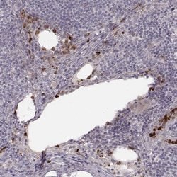 Invitrogen ABCA7 Polyclonal Antibody 100 &mu;L; Unconjugated:Antibodies,