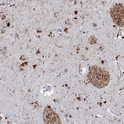 Invitrogen C16orf72 Polyclonal Antibody 100 &mu;L; Unconjugated:Antibodies,