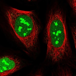 Invitrogen TMA16 Polyclonal Antibody 100 &mu;L; Unconjugated:Antibodies,
