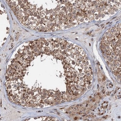 Invitrogen TMA16 Polyclonal Antibody 100 &mu;L; Unconjugated:Antibodies,