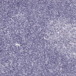 Invitrogen PABPC1L2A Polyclonal Antibody 100 &mu;L | Buy Online | Invitrogen&trade; | Fisher Scientific