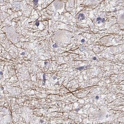 Invitrogen PABPC1L2A Polyclonal Antibody 100 &mu;L | Buy Online | Invitrogen&trade; | Fisher Scientific