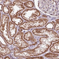 Invitrogen SQRDL Polyclonal Antibody 100 &mu;L; Unconjugated:Antibodies,