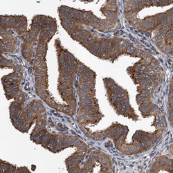 Invitrogen MDM1 Polyclonal Antibody 100 &mu;L; Unconjugated:Antibodies,