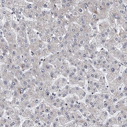 Invitrogen MDM1 Polyclonal Antibody 100 &mu;L; Unconjugated:Antibodies,