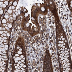Invitrogen MDM1 Polyclonal Antibody 100 &mu;L; Unconjugated:Antibodies,