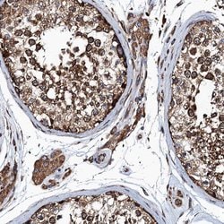 Invitrogen MDM1 Polyclonal Antibody 100 &mu;L; Unconjugated:Antibodies,