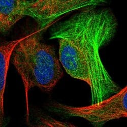 Invitrogen ALG2 Polyclonal Antibody 100 &mu;L; Unconjugated:Antibodies,