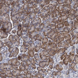 Invitrogen ALG2 Polyclonal Antibody 100 &mu;L; Unconjugated:Antibodies,