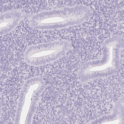 Invitrogen SGLT2 Polyclonal Antibody 100 &mu;L; Unconjugated:Antibodies,