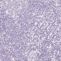 Invitrogen SGLT2 Polyclonal Antibody 100 &mu;L; Unconjugated:Antibodies,