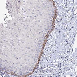 Invitrogen FAM86A Polyclonal Antibody 100 &mu;L; Unconjugated:Antibodies,