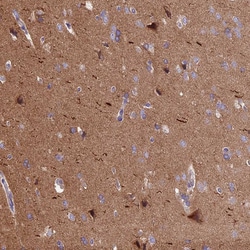 Invitrogen ANO3 Polyclonal Antibody 100 &mu;L; Unconjugated:Antibodies,