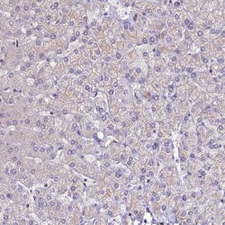 Invitrogen ANO3 Polyclonal Antibody 100 &mu;L; Unconjugated:Antibodies,