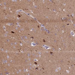 Invitrogen ANO3 Polyclonal Antibody 100 &mu;L; Unconjugated:Antibodies,