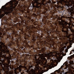 Invitrogen ART5 Polyclonal Antibody 100 &mu;L | Buy Online | Invitrogen&trade; | Fisher Scientific