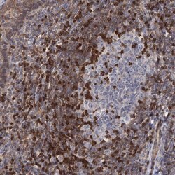 Invitrogen DGKA Polyclonal Antibody 100 &mu;L; Unconjugated:Antibodies,
