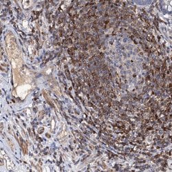 Invitrogen DGKA Polyclonal Antibody 100 &mu;L; Unconjugated:Antibodies,