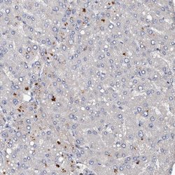 Invitrogen DGKA Polyclonal Antibody 100 &mu;L; Unconjugated:Antibodies,