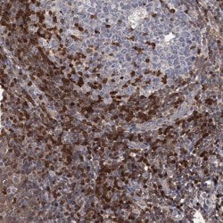 Invitrogen DGKA Polyclonal Antibody 100 &mu;L; Unconjugated:Antibodies,